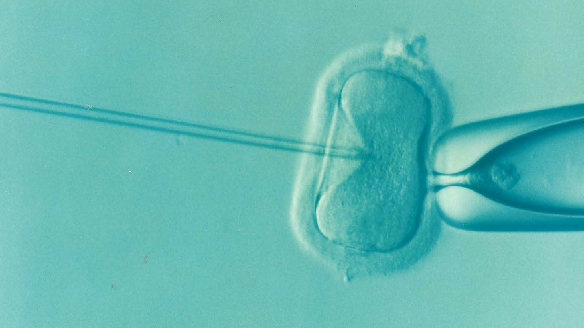 IVF - In Vitro Fertilization